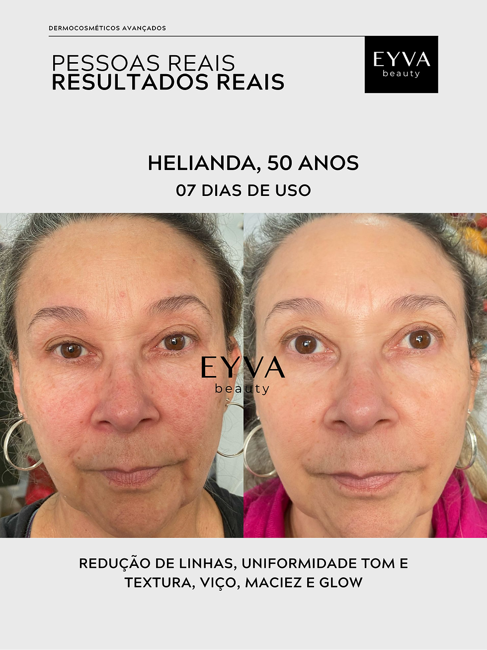 Miniatura: SERUM EFEITO BOTOX E PREENCHEDOR
