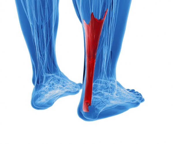 Mastering Achilles Tendinopathy: Your Complete Guide to Understanding, Healing, and being pain free