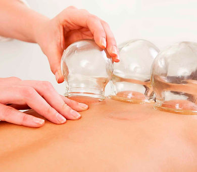 cupping.jpg