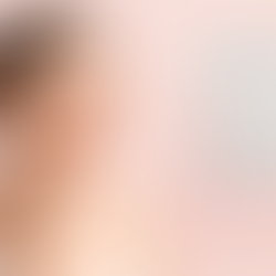 Preciso usar protetor mesmo em dias nublados?