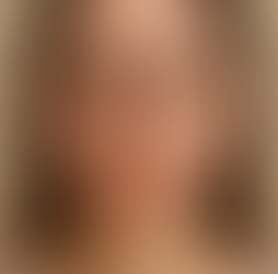 7 Sinais de que Sua Alimentação Está Prejudicando Sua Pele (E Como Melhorar Sua Saúde Cutânea)