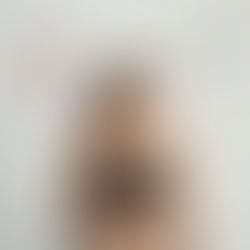 Por que Mulheres Têm Mais Dificuldade para Emagrecer? Entenda os Fatores Reais e Como Superar