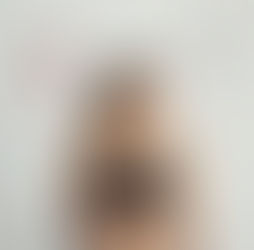 Por que Mulheres Têm Mais Dificuldade para Emagrecer? Entenda os Fatores Reais e Como Superar