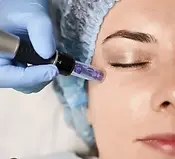 microneedling.webp