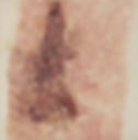 Fading Black and Blue 1