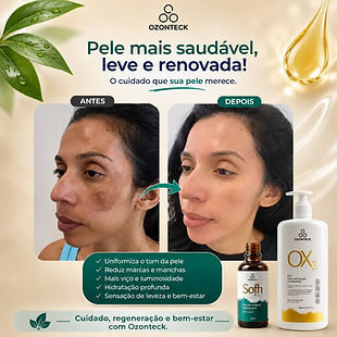 Antes e depois de rotina de cuidado da pele com produtos Ozonteck
