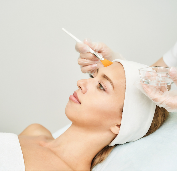 chemical peel.png