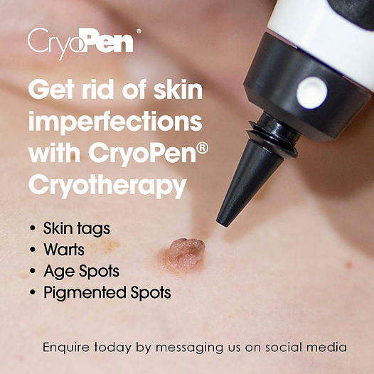 Cryo Social Media Post.jpg