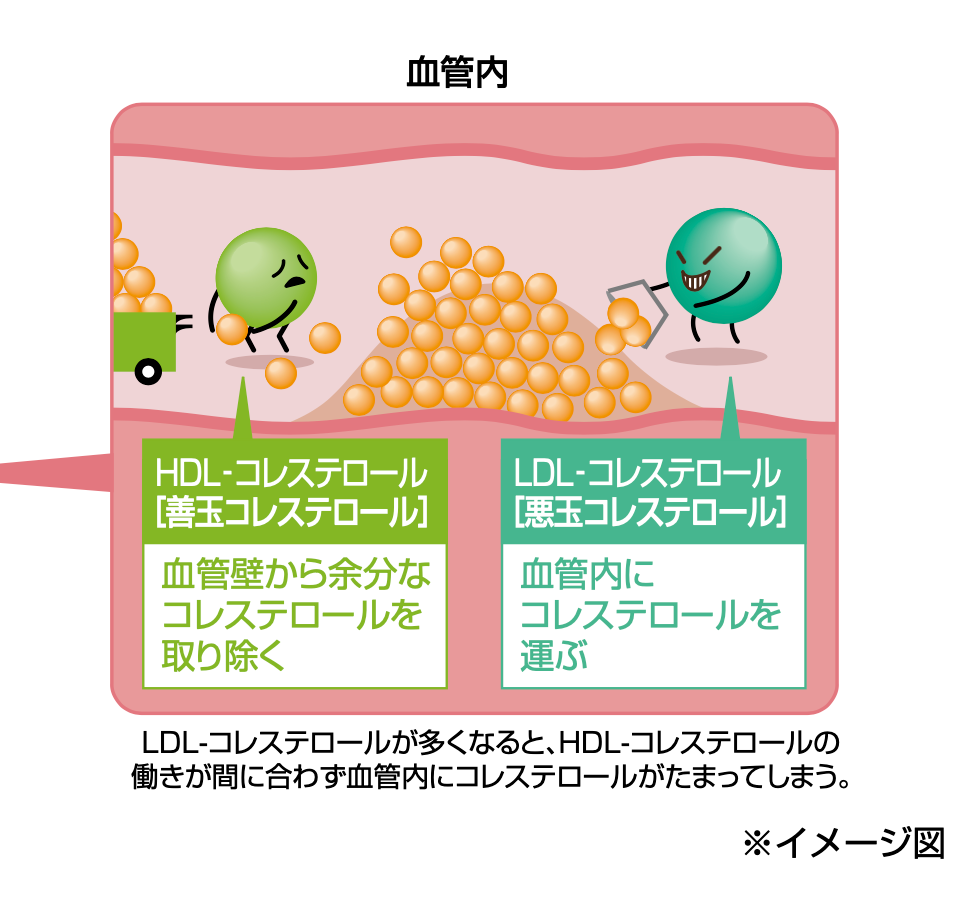 コレステロールの循環
LDL-コレステロールが多くなると、HDL-コレステロールの働きが間に合わず血管内にコレステロールがたまってしまう。
