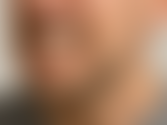 Teeth clenching and grinding