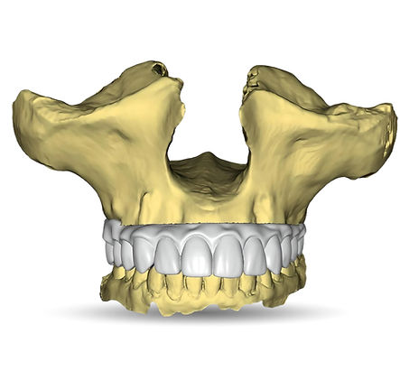 At AA Dental Design, we’re here to make your workflow easier! Whether you're new to digital dentistry or an experienced pro, our CAD design support helps you streamline your process so you can focus on what matters most, your patients. Our plug-and-play model fits right into your existing setup, making it simple to scale and work more efficiently.