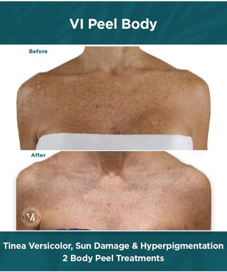 LAVISHiBROWS Winter Garden VI PEEL