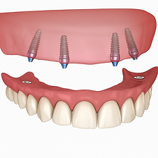 image4.png