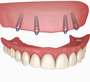 image4.png