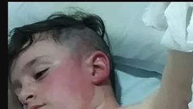 NIÑO QUEMADO EN COLEGIO DE BALLESTER