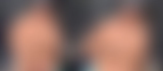 Influenciador Gordão da XJ exibe nova forma após perder mais de 115 kg