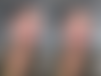 Juliette mostra rosto inchado após procedimento