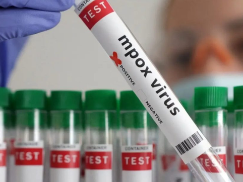 Mpox no RN chega a 12 casos e novos registros são confirmados pela Saúde