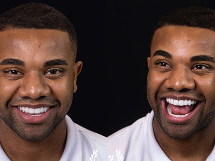 Davi Brito passa por transformação nos dentes após críticas. Veja antes e depois!
