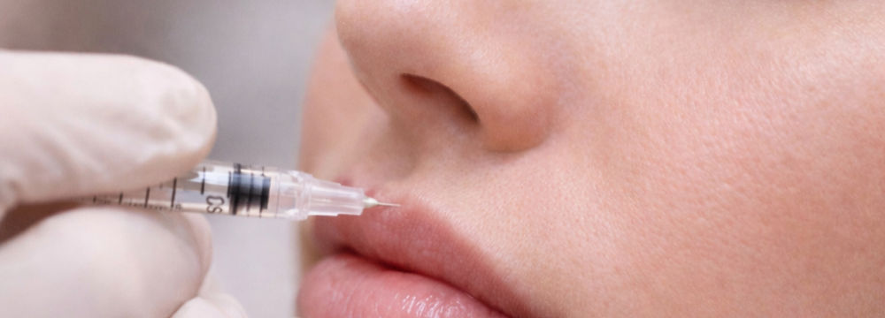 Dermal filler treatment for lip enhancement and facial contouring