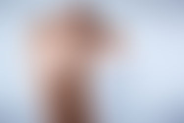 脱毛したら毛が濃くなった?