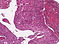 J01