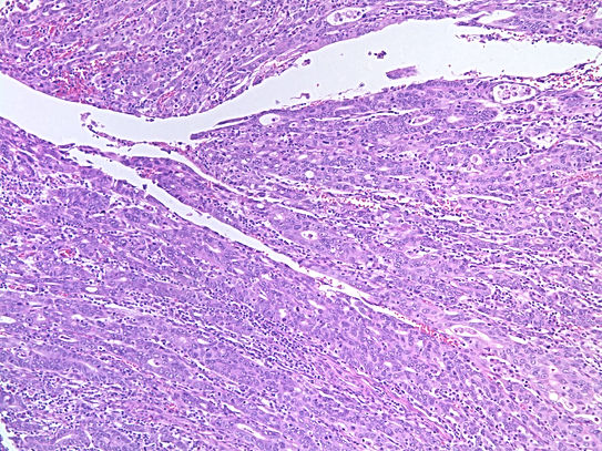 UNC241A-C02.jpg