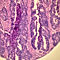 J04