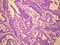 E02
