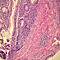 J05