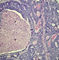 I01