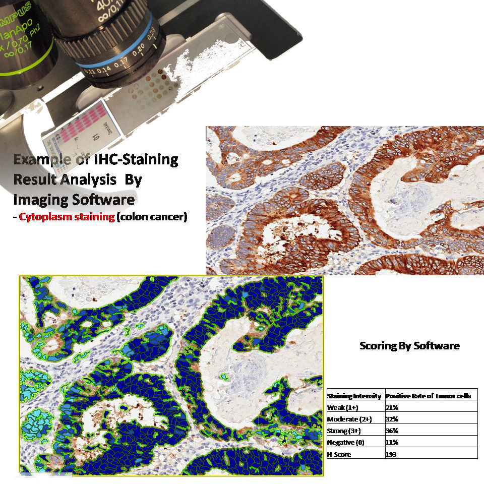 Thumbnail: PC quantitative image analysis
