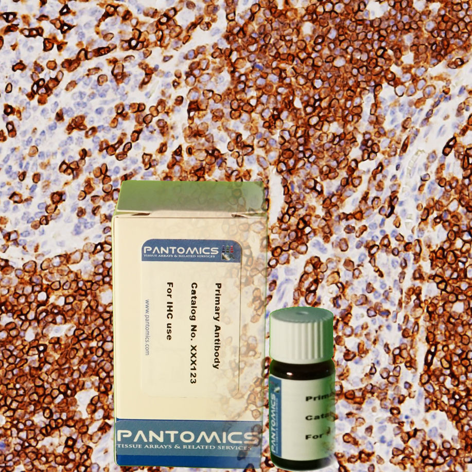 Thumbnail: CD3 Rabbit Monoclonal Antibody