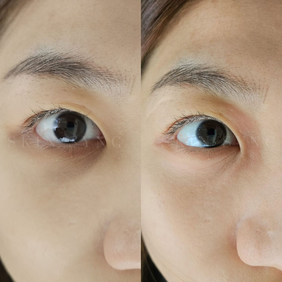 neu tattoo skin camouflage. skin camo. dark undereye concealer in sg