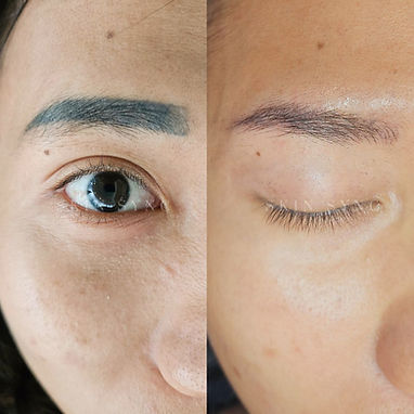 eyebrow embroidery removal brow sync rest