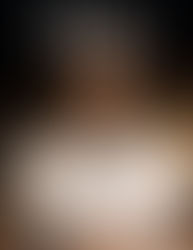 Polimedicación, una mirada a las soluciones SPD en farmacéuticas