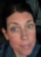 post microneedling