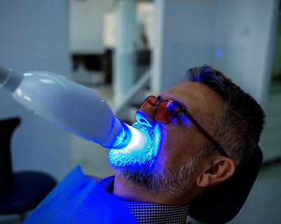 Teeth whitening cheshire social media (5)_edited.jpg