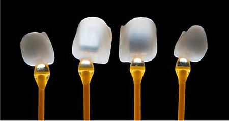 On which teeth can e-max crown be applied in kusadasi,turkey