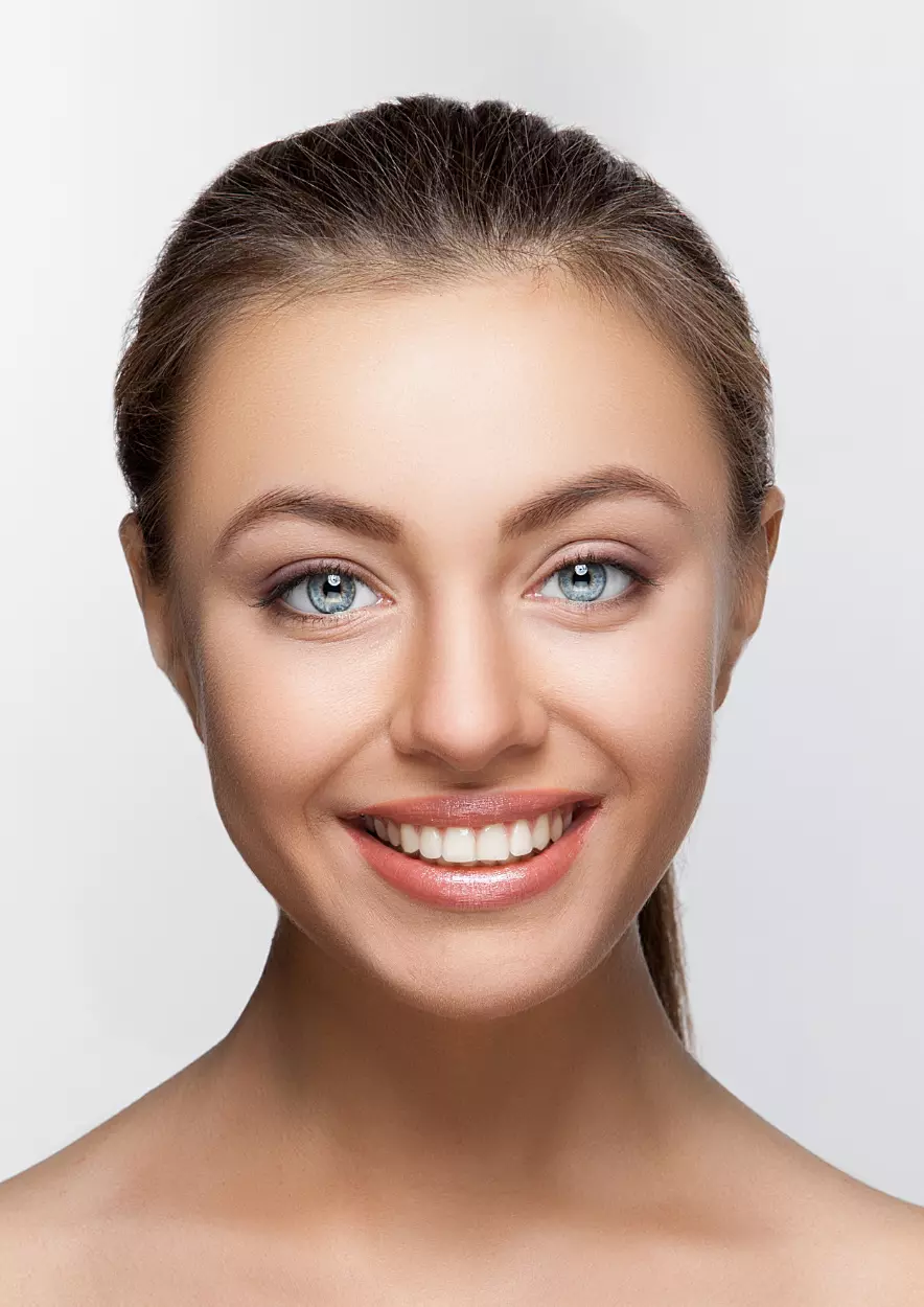 What is smile makeover- kusadasi,turkey