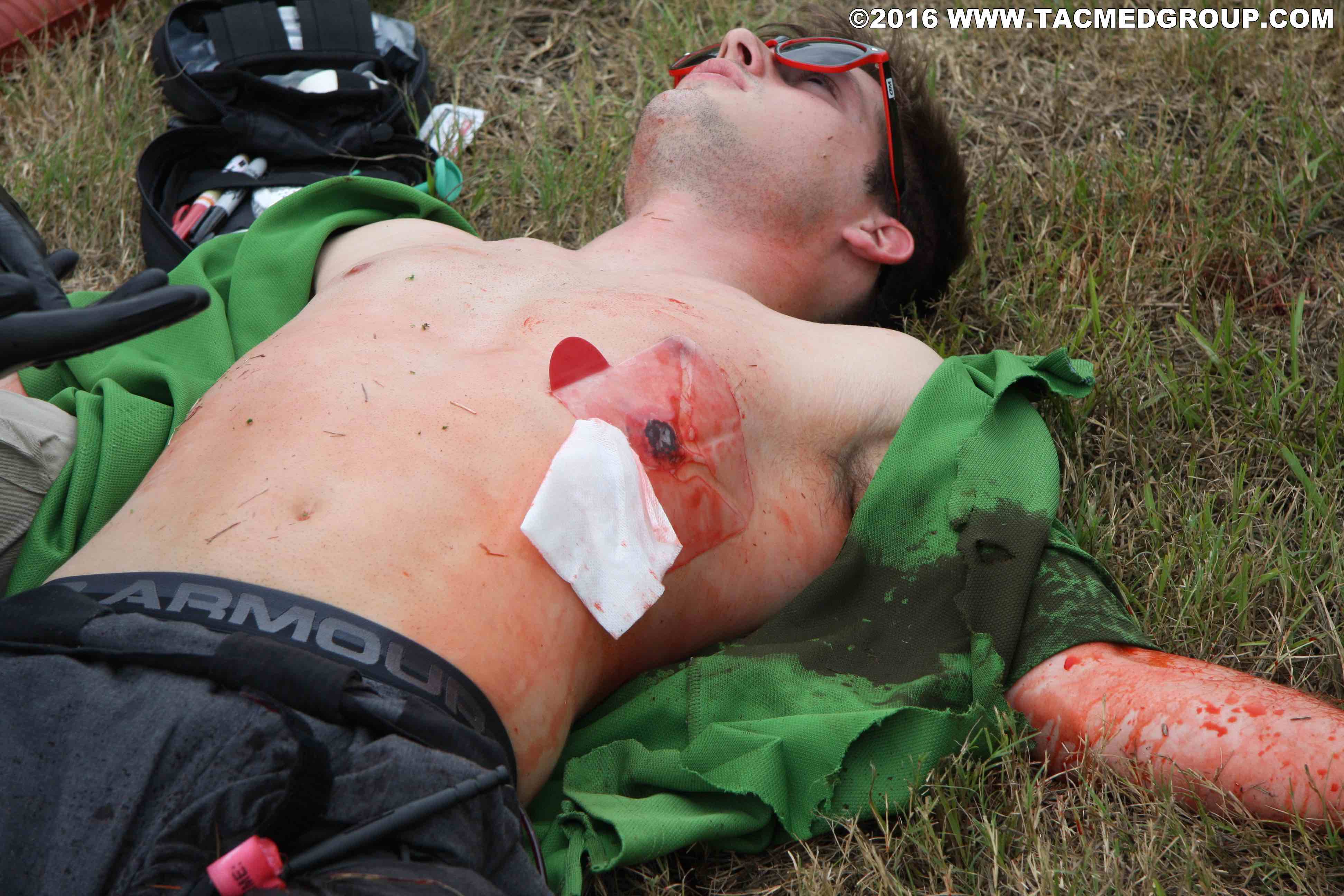 TCCC Chest wound treated