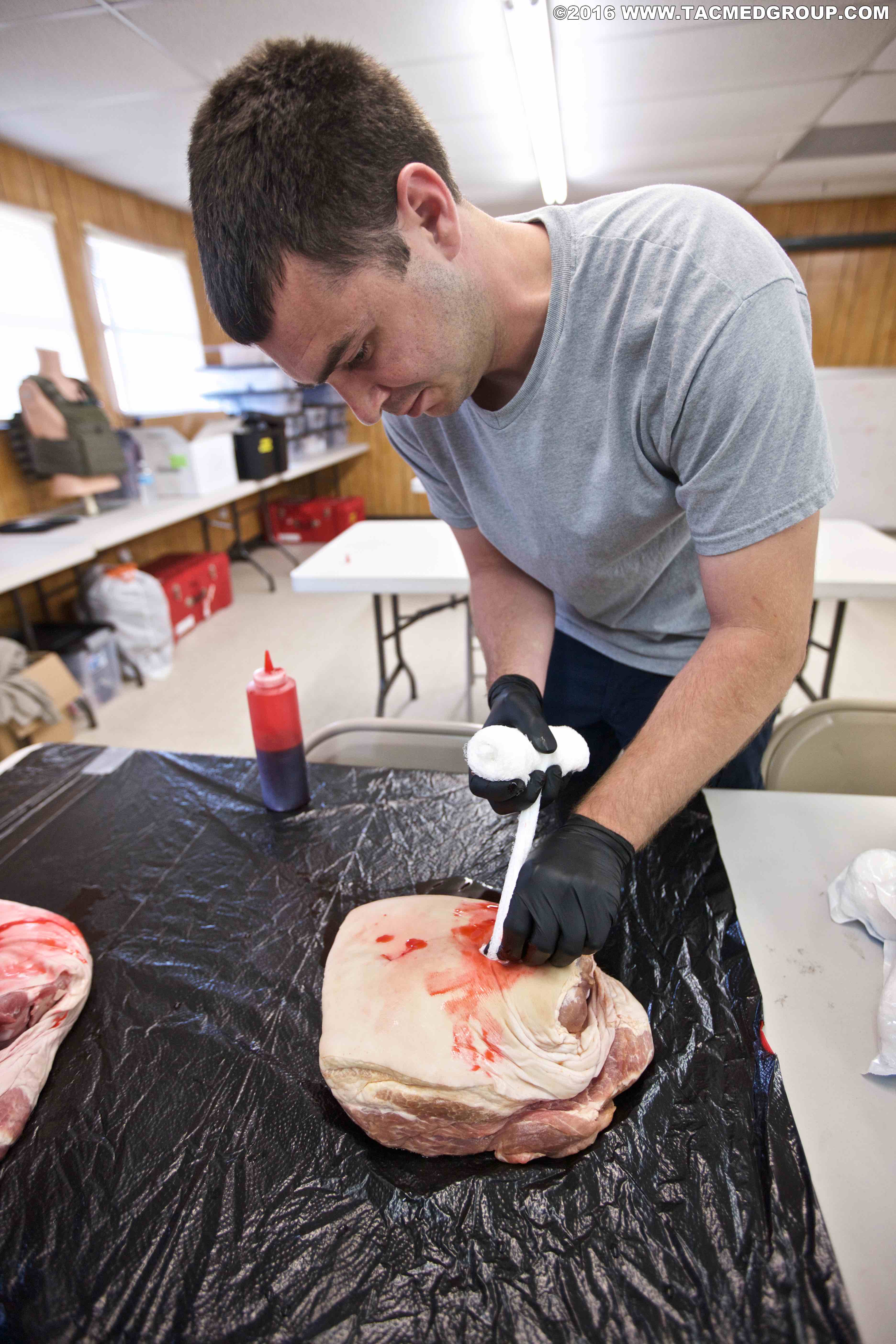 Wound Packing Rump