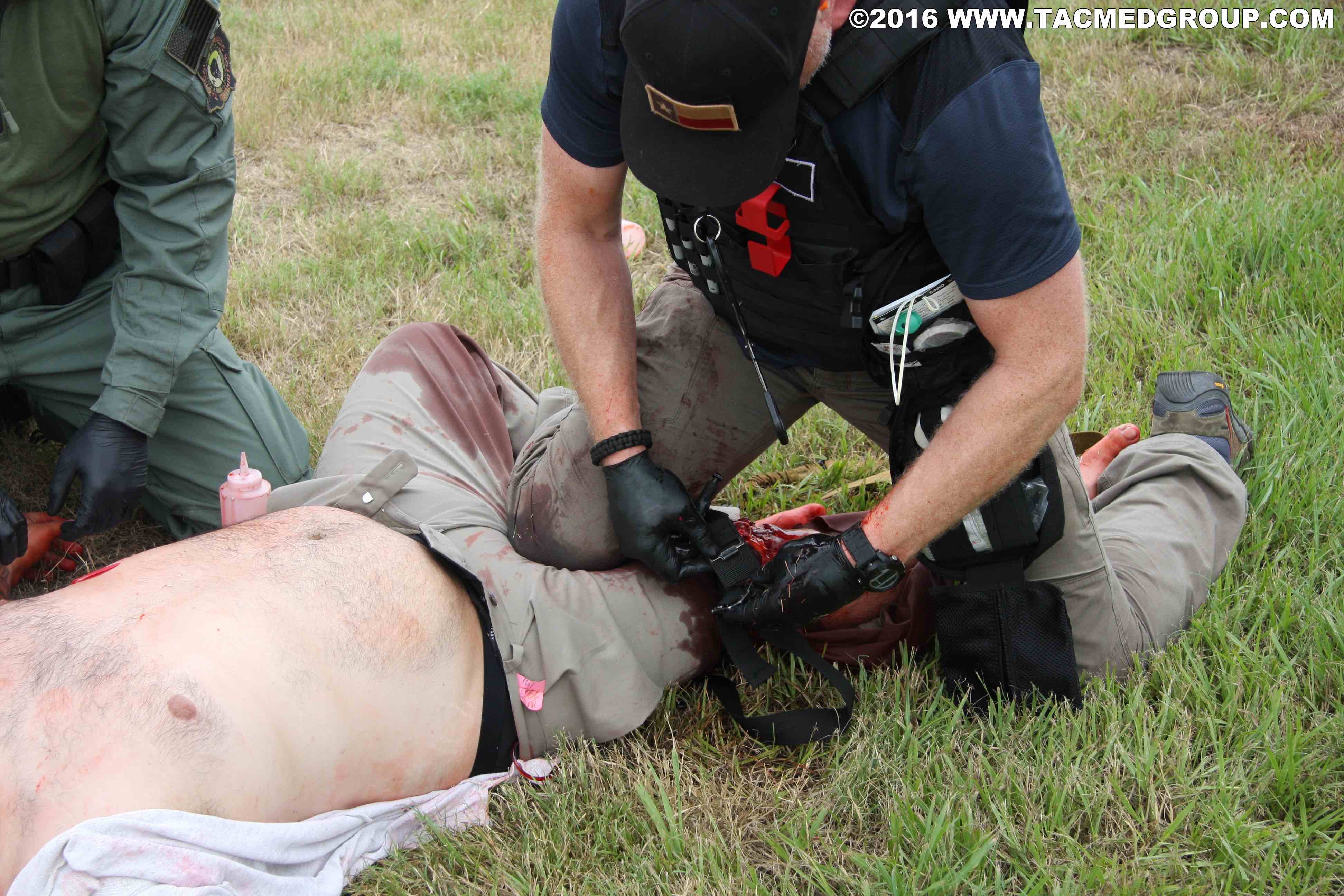 TCCC Knee in Groin TQ on