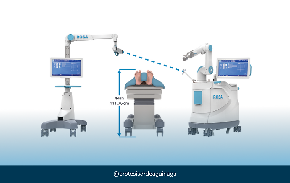 Desgaste de Rodilla_Gonartrosis