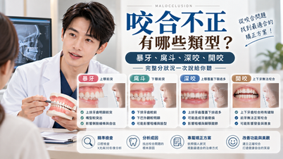 咬合不正有哪些類型?暴牙、戽斗、深咬、開咬完整分狀況一次說給你聽