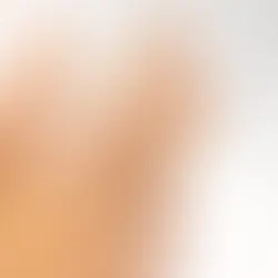 Choosing the Right Metal for Your Splint: Care, Cleaning, and What to Expect