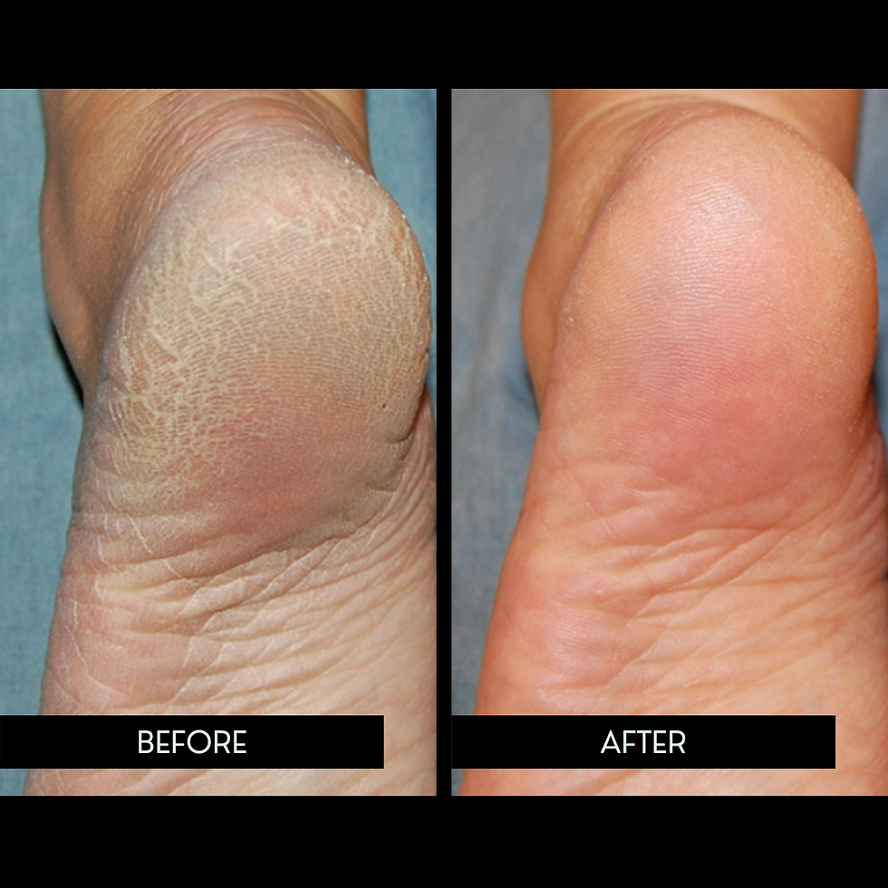 Putting Your Best Foot Forward The Surprising Benefits Of Regular putting-your-best-foot-forward-the-surprising-benefits-of-regular