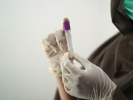 Come leggere le analisi del testosterone: quali sono i valori di riferimento