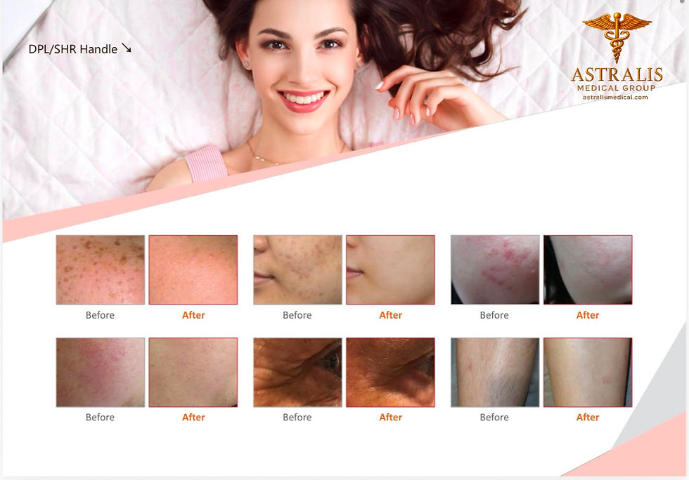 Thumbnail: ASTRALIS AML600™ – 5-IN-1 MULTIFUNCTIONAL AESTHETIC PLATFORM