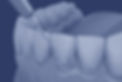 Periodoncia-TEMP.jpg